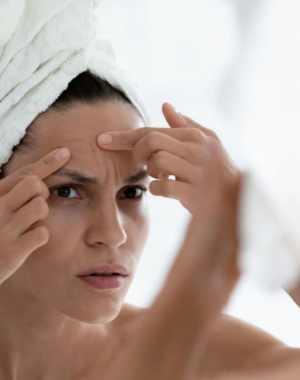 چطور از ایجاد جوش بعد از آرایش جلوگیری کنیم